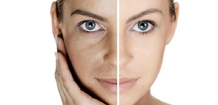 before and after the rejuvenation of facial skin